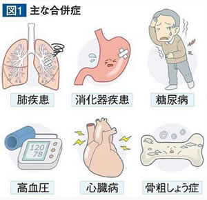 主な合併症