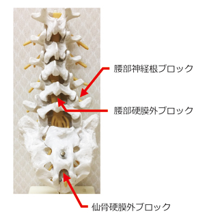 神経根ブロック